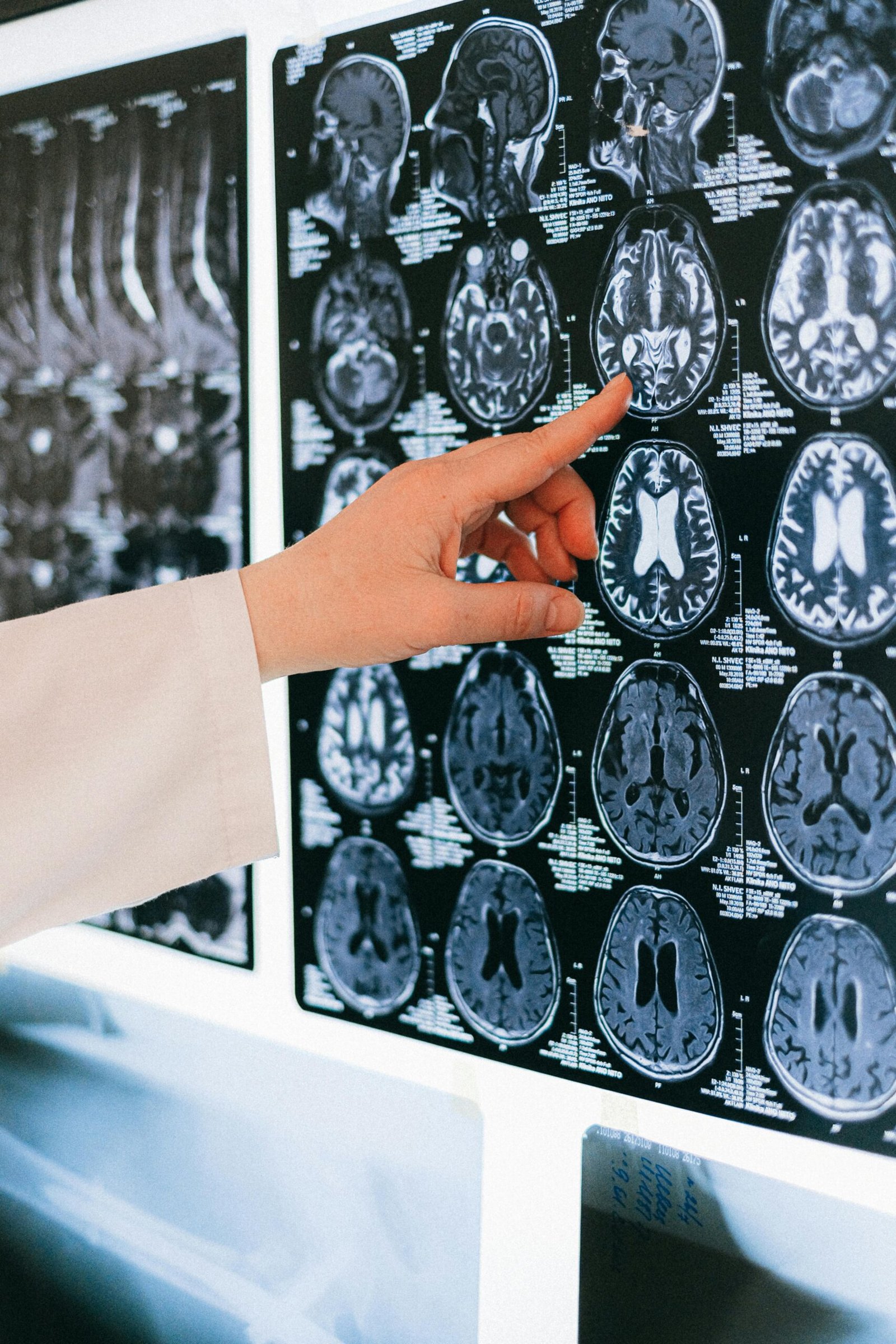 pexels photo 4226119 4226119 A doctor's hand points to a brain MRI scan on a lightbox, illustrating medical diagnosis.
